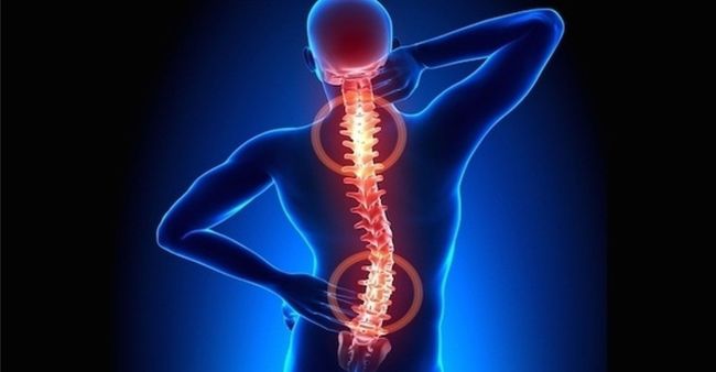 Osteoporosis
Diagnóstico y tratamiento