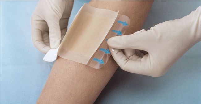 Heridas de difícil cicatrización