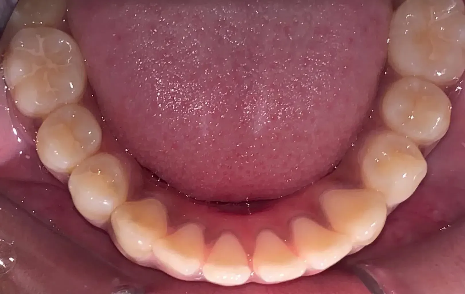 A close up of a man 's teeth with a beard.