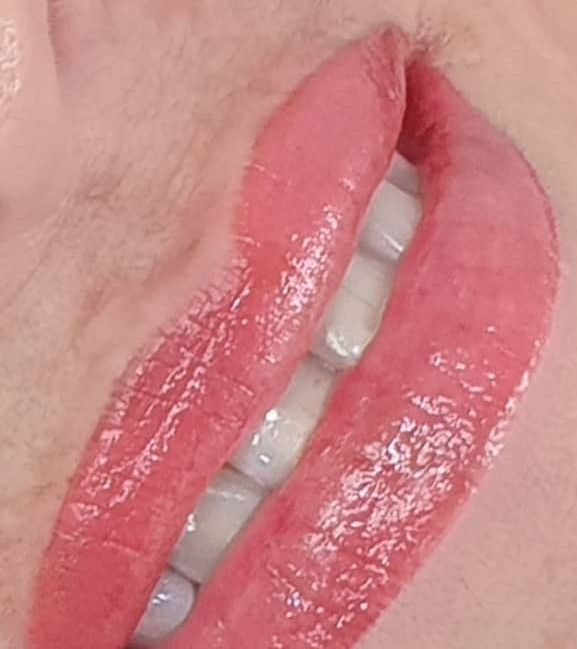 Pink Lips Slightly Parted, Revealing White Teeth — On Point Cosmetic Tattoo Studio In Buderim, QLD