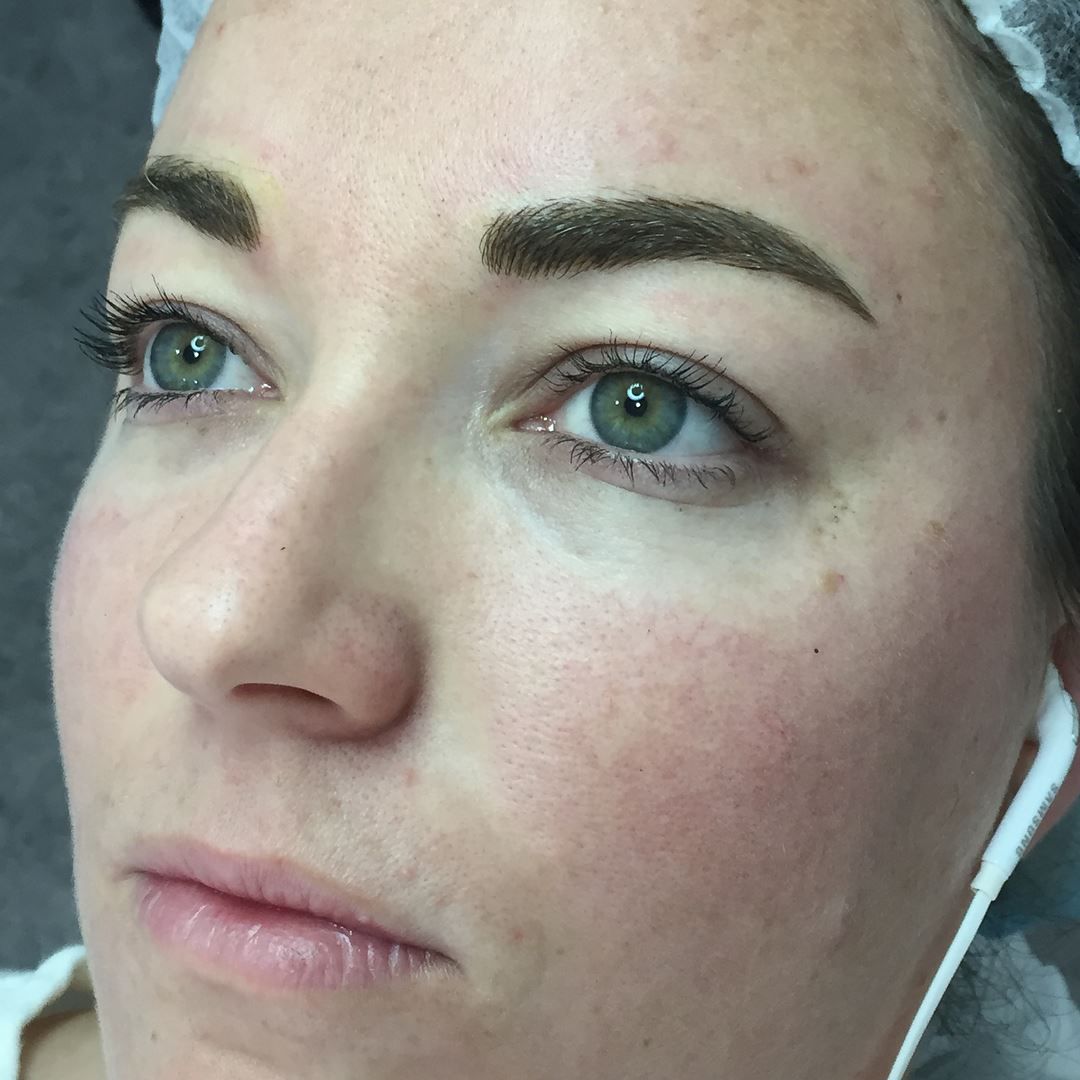 Woman With Newly Tattooed Eyebrows and Fair Skin — On Point Cosmetic Tattoo Studio In Buderim, QLD