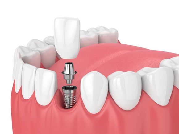 cieffe dentista