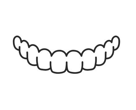 sbiancamento dentale