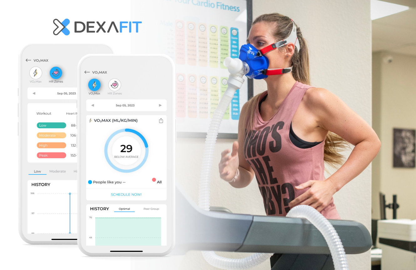 full body dexa scan
