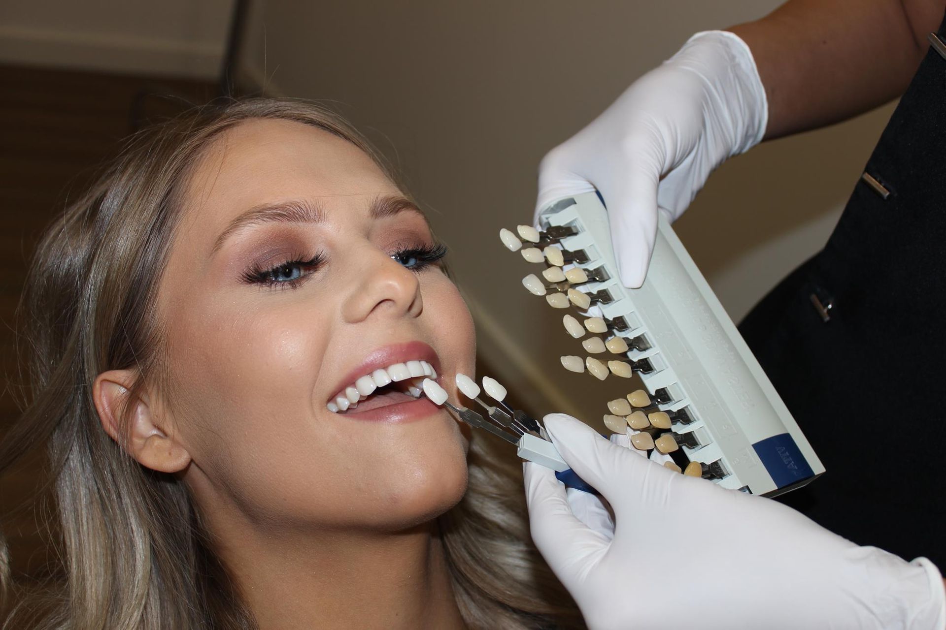 Dental Results Melbourne, VIC D'vine Smiles