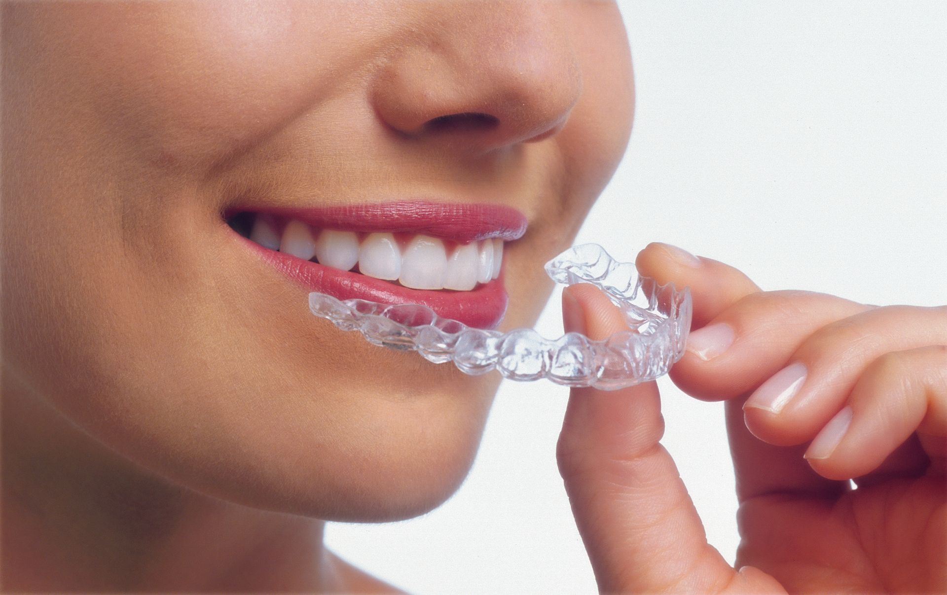 Woman holding clear aligner near teeth.