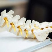 A model of a human lumbar spine and sacrum with yellow intervertebral discs resting on a white surface.