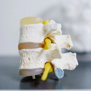An anatomical model of three human vertebrae with intervertebral discs and yellow spinal nerves on a desk.