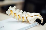 A model of a human lumbar spine and sacrum with yellow intervertebral discs resting on a white surface.