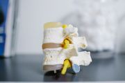 An anatomical model of three human vertebrae with intervertebral discs and yellow spinal nerves on a desk.