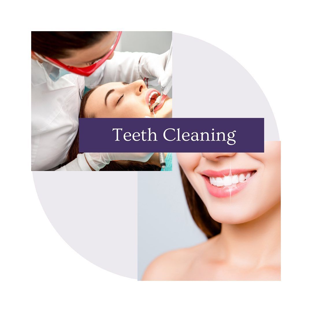 Teeth cleaning and a girl smiling on the back – Blacktown, NSW – Smiles for All