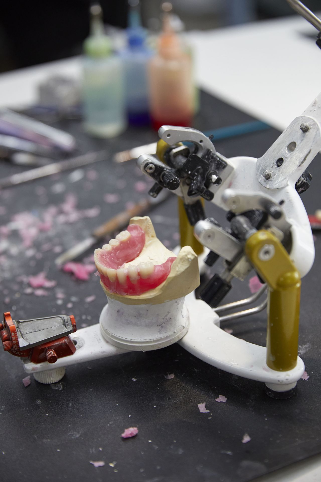 Customised Full Dentures — North Turramurra, NSW — Turramurra Denture Studio