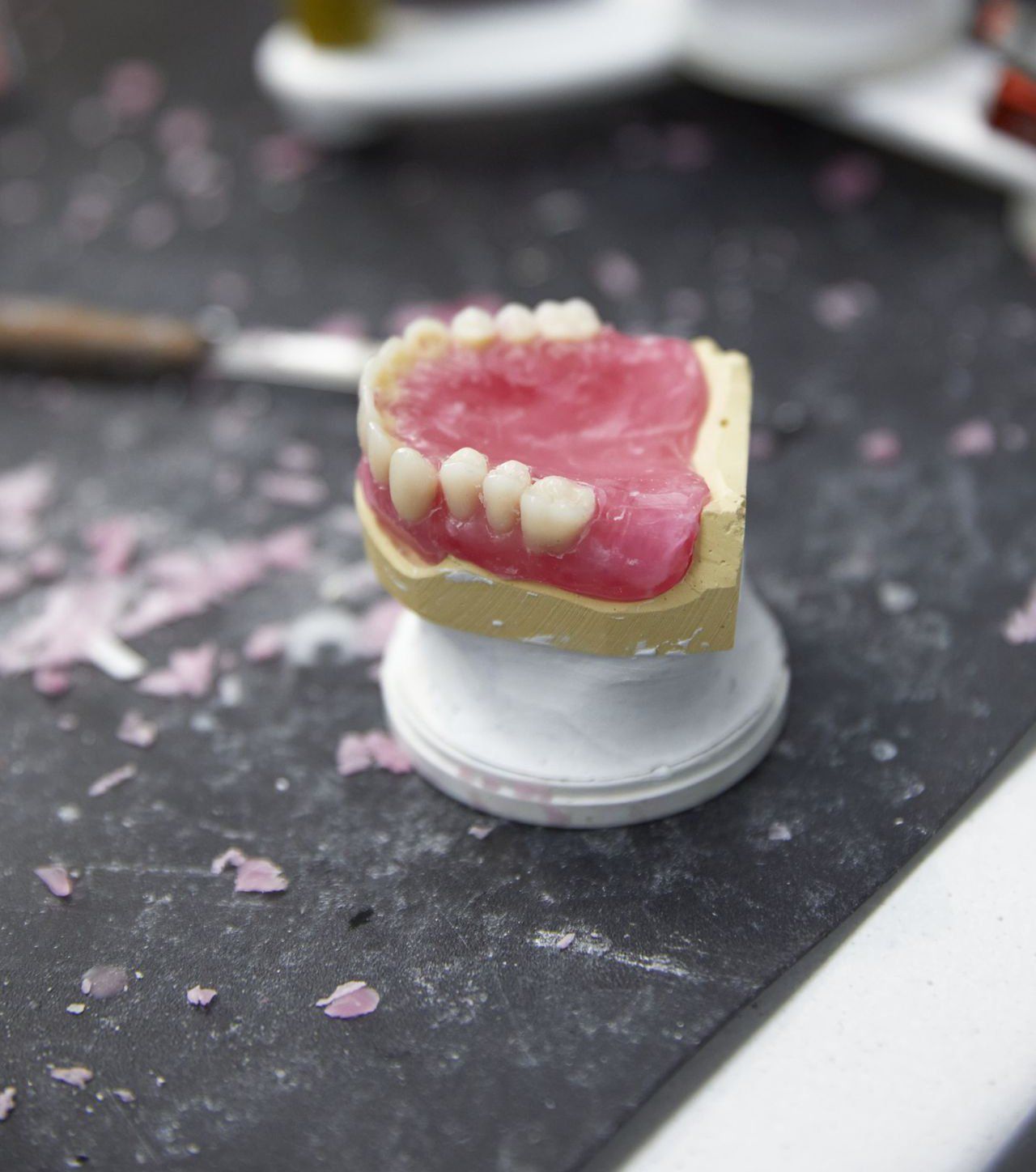 Full Dentures — North Turramurra, NSW — Turramurra Denture Studio