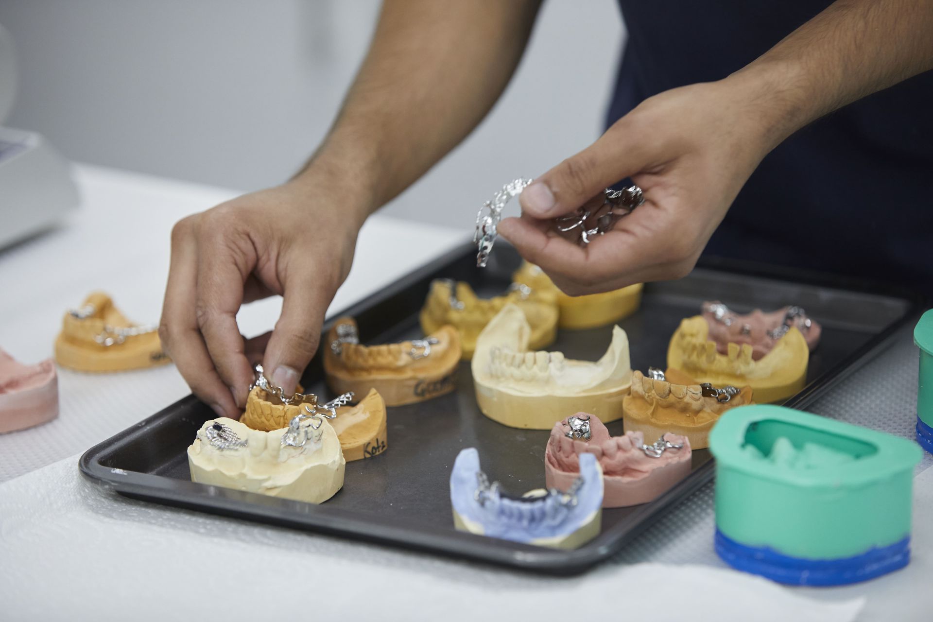 Customised Partial Dentures — North Turramurra, NSW — Turramurra Denture Studio