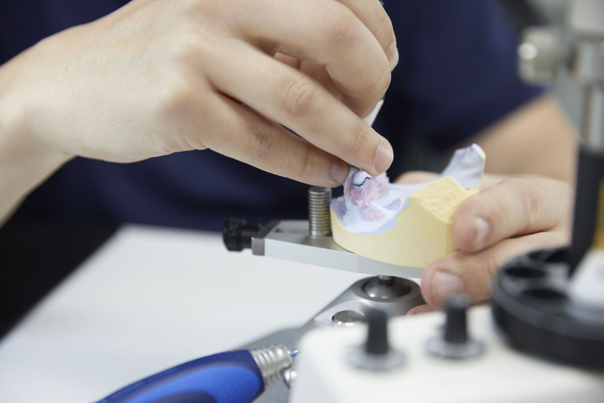Dental Mouthguards — North Turramurra, NSW — Turramurra Denture Studio