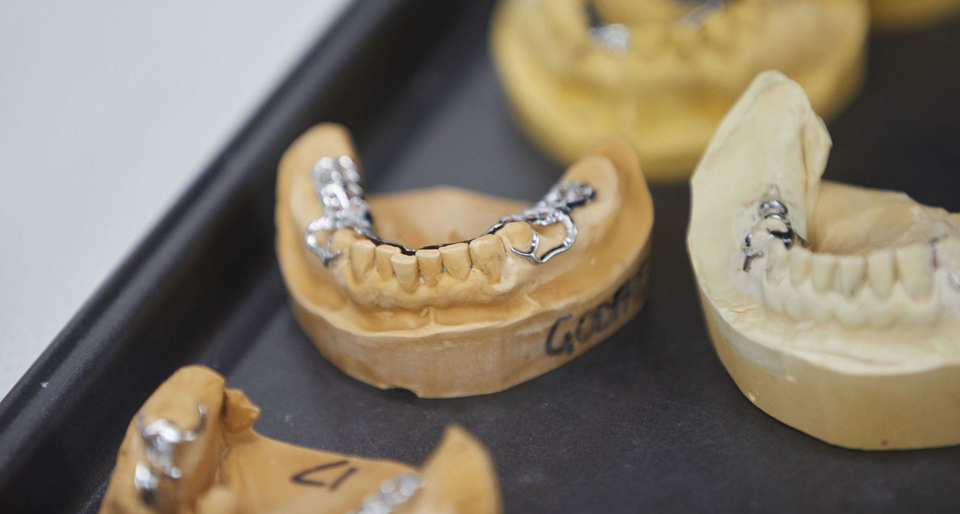 Partial Dentures — North Turramurra, NSW — Turramurra Denture Studio