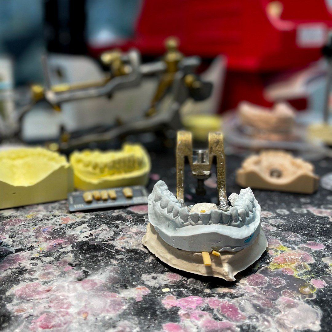 Dental Wax Models — North Turramurra, NSW — Turramurra Denture Studio