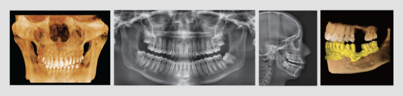 A collage of three images of a skull and teeth.