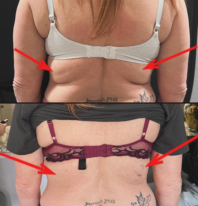 Medical Weight Loss | Luxury Lounge Aesthetics & IV Wellness