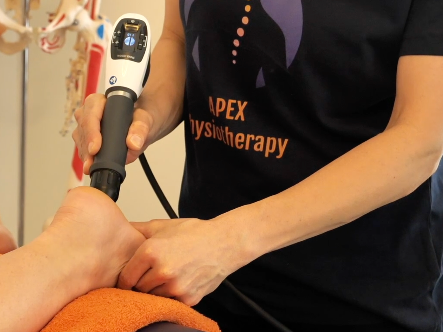 shockwave therapy