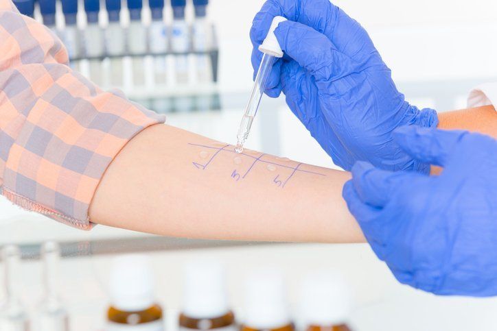 Una persona si sta sottoponendo a un test allergico sul braccio.