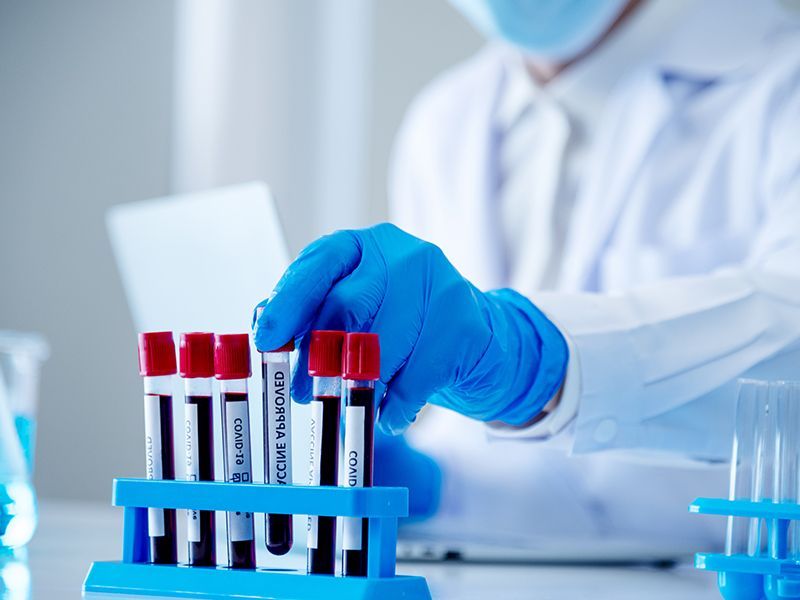 Uno scienziato tiene in mano una provetta in un laboratorio.