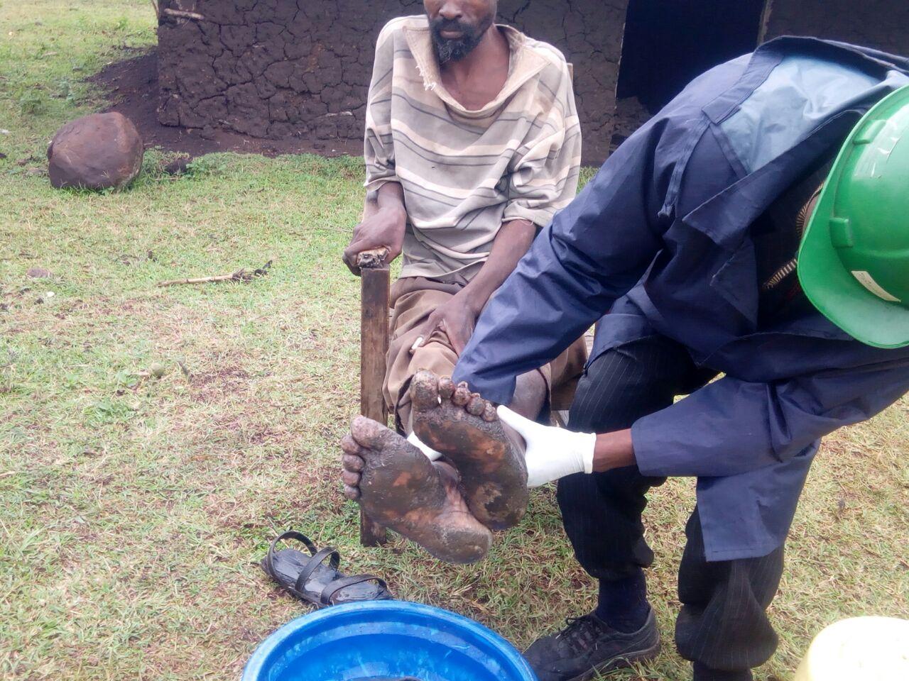 Worker in green hard hat examining a large hoof while another person sits nearby outdoors
