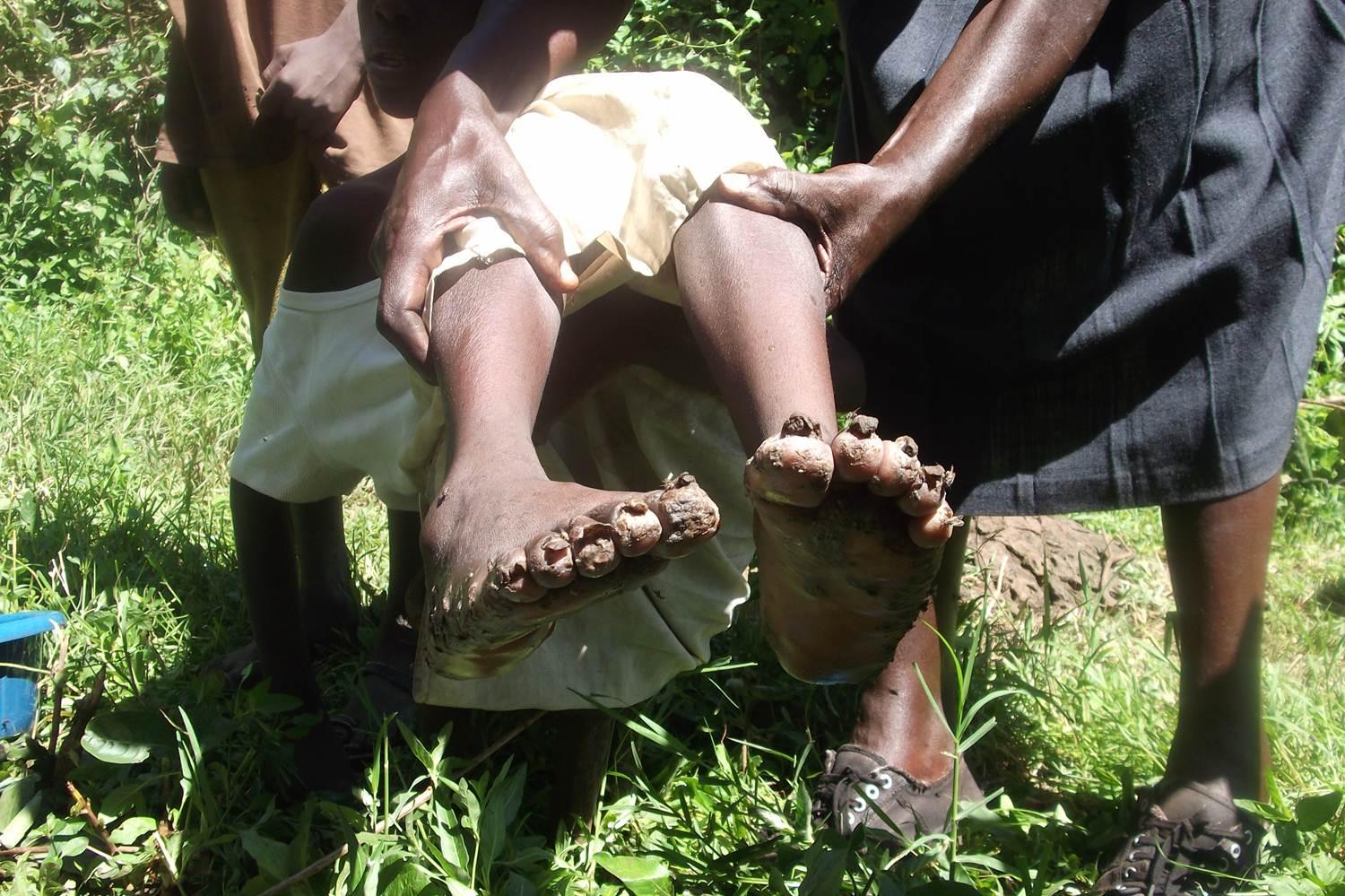 People carrying an injured person by the legs outdoors on grass
