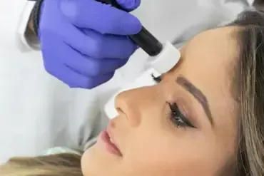 Collagen Induction Therapy
