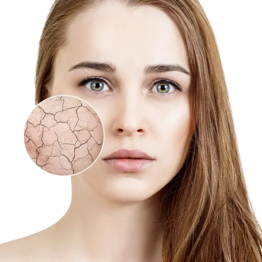 How to Repair Damaged Skin Barrier for Dry and Dehydrated Skin