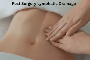 Post-Plastic Surgery Lymphatic Drainage