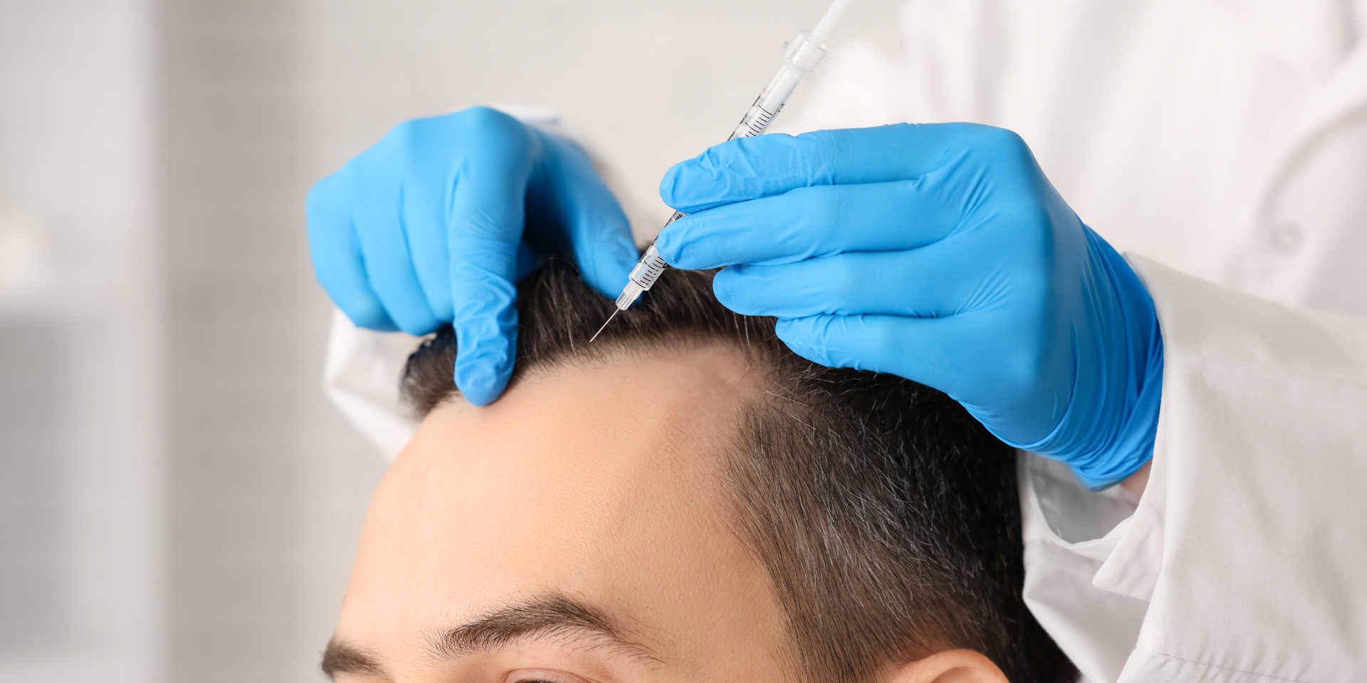 Illustration showing electrolysis process. A needle is inserted into a hair follicle to destroy the hair root.
