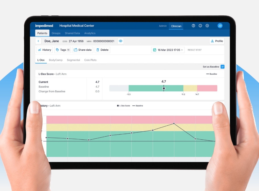 Hands using a tablet displaying a dashboard with charts and colored progress bars