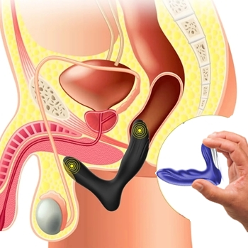 plug anal estimulador de prostata vibrador dilatador sex shop exotic house em fortaleza
