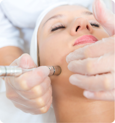 Person receiving microneedling treatment on the cheek; technician's gloved hand holds device.