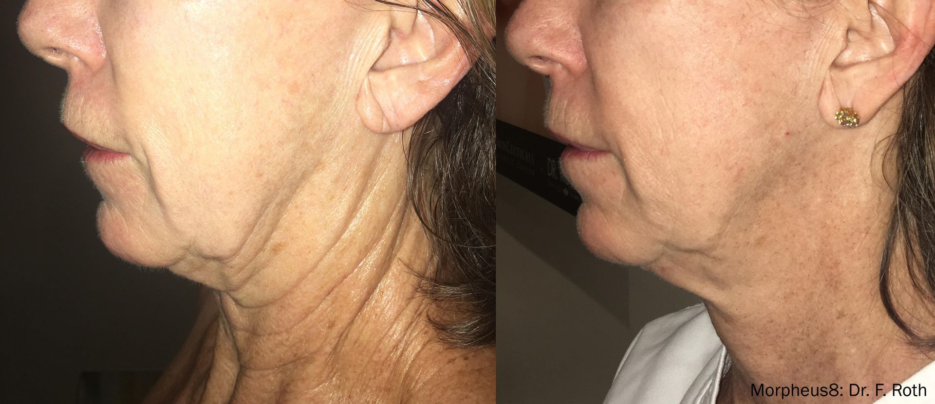 Facial rejuvenation services at Wagoner Family Health Clinic Nacogdoches TX
