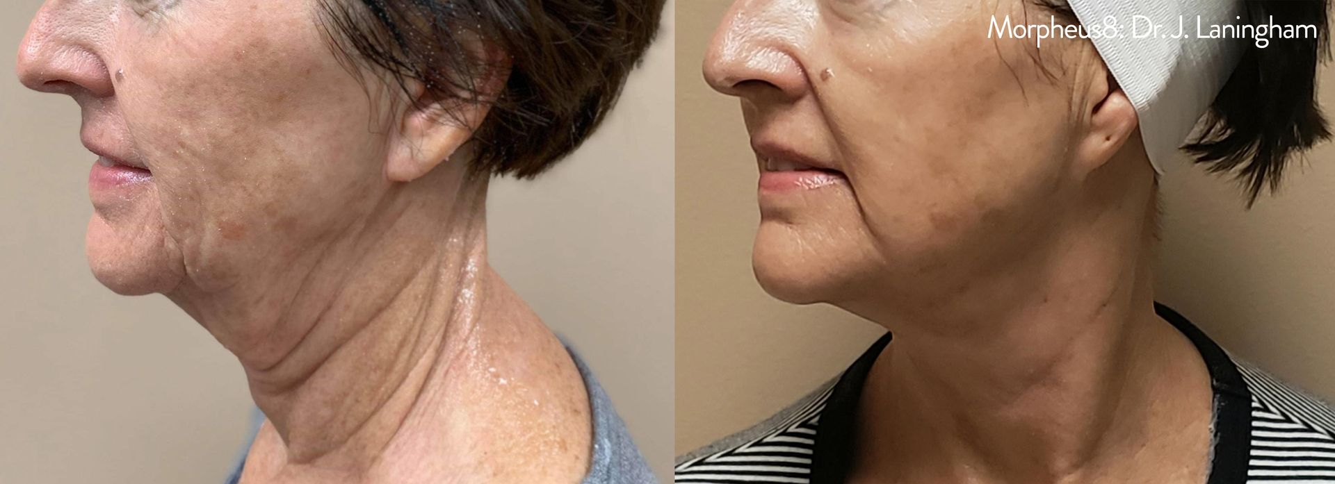 Wrinkle Treatment services at Wagoner Family Health Clinic Nacogdoches TX