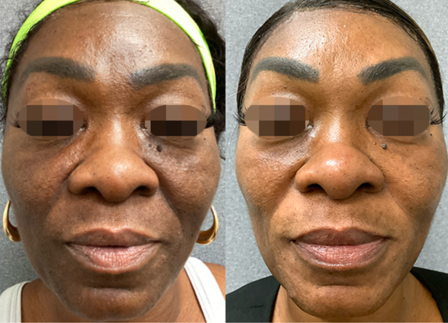 Professional skin treatment services at Wagoner Family Health Clinic Nacogdoches TX