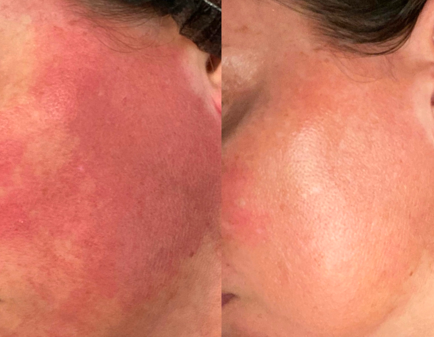 Professional skin treatment services at Wagoner Family Health Clinic Nacogdoches TX