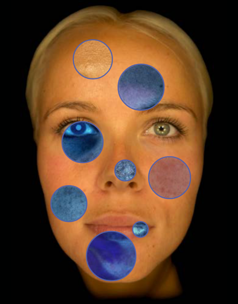 Woman's face with blue circles highlighting areas of the skin, including the eye and mouth.