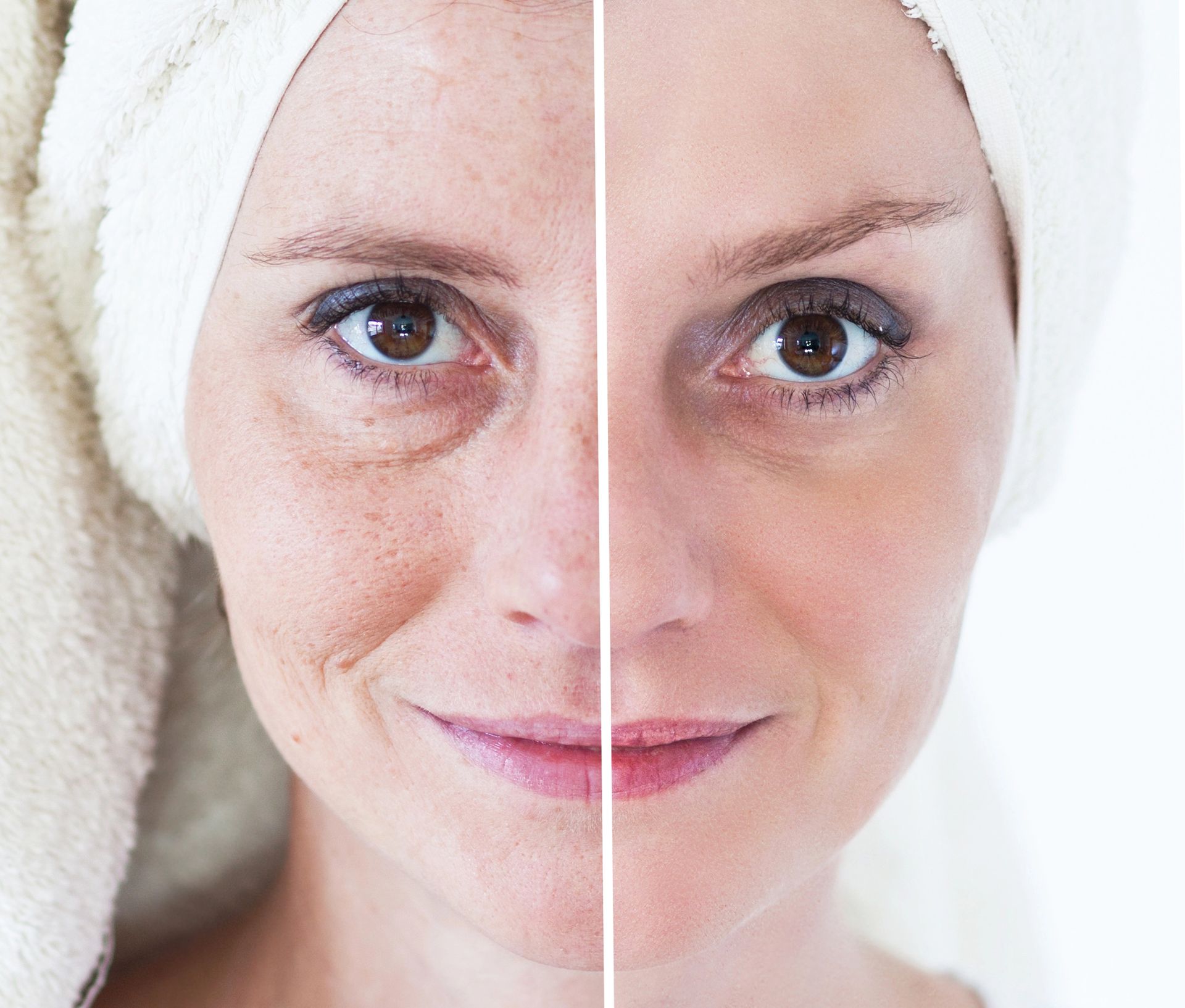 Antiaging in Texarkana, TX Antiaging in Texarkana, TX