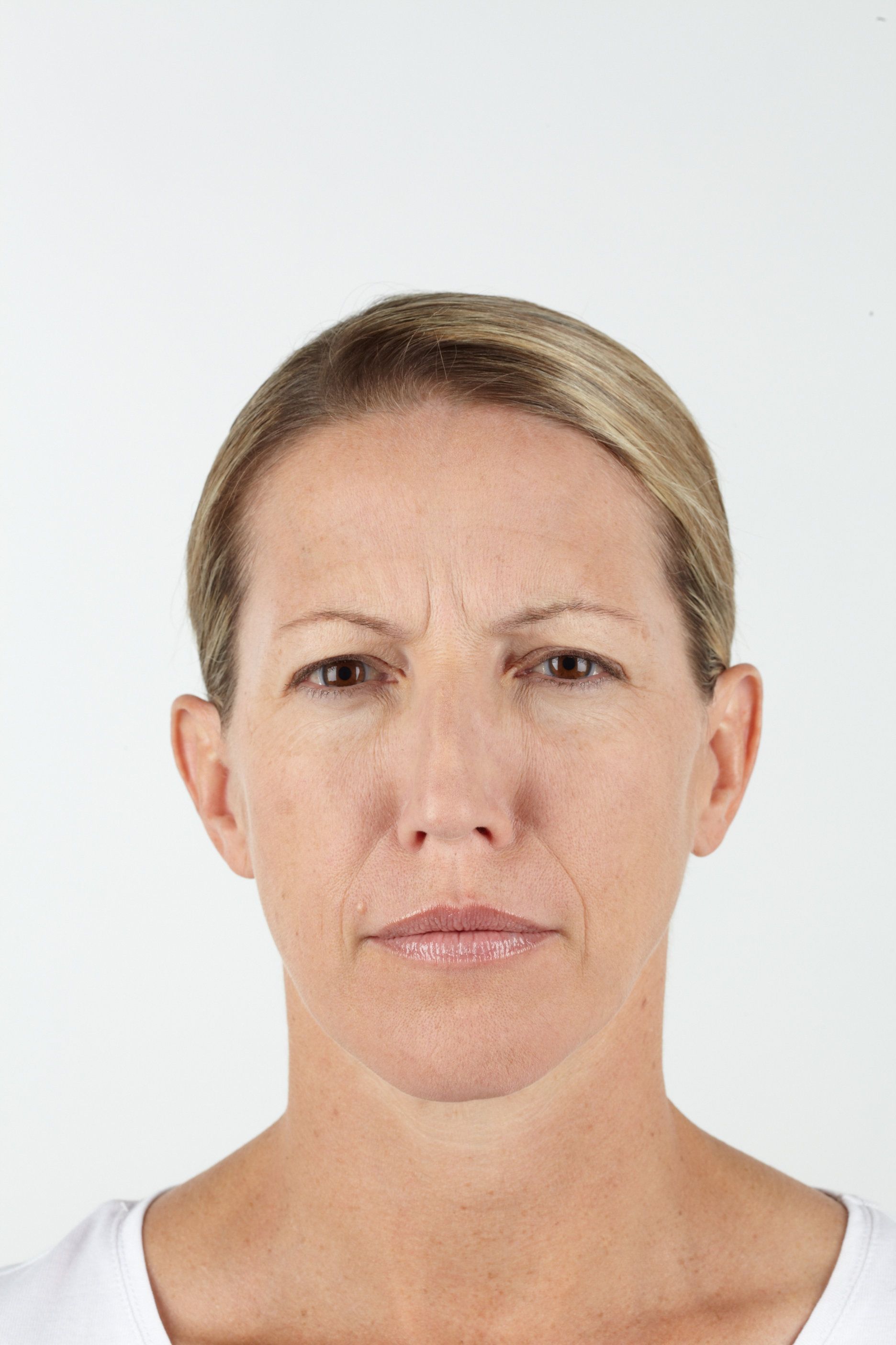 Woman with furrowed brow, showing wrinkles, looking forward against a white background.