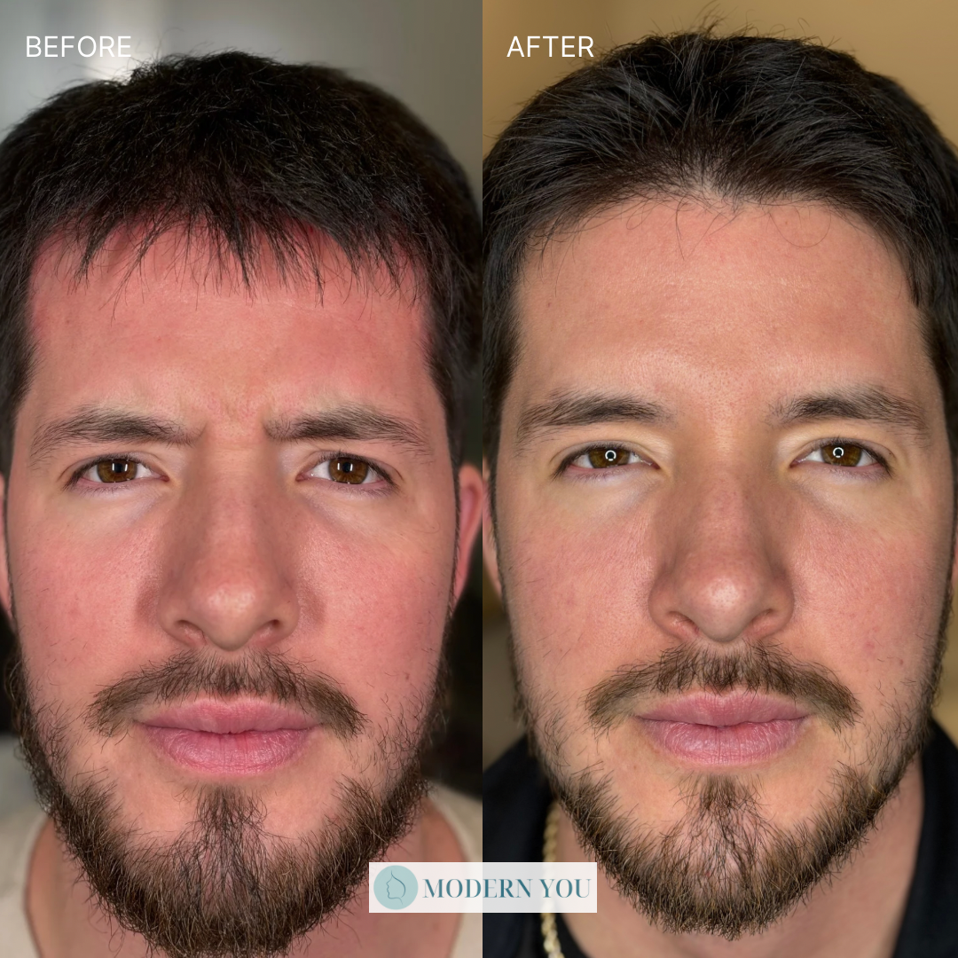 Side-by-side photos of a man's face: 