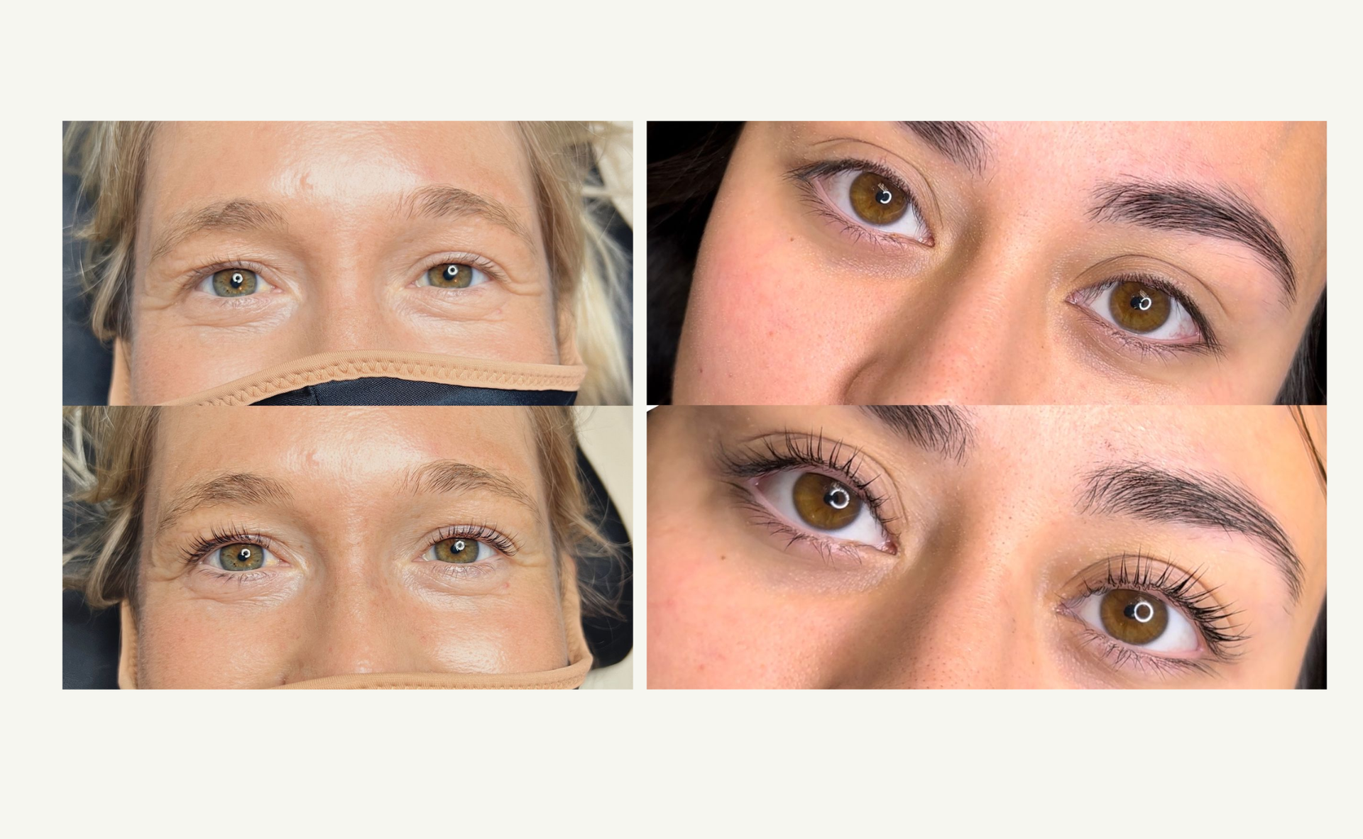 Close-up comparison of eyes and eyebrows before and after cosmetic enhancement on two faces