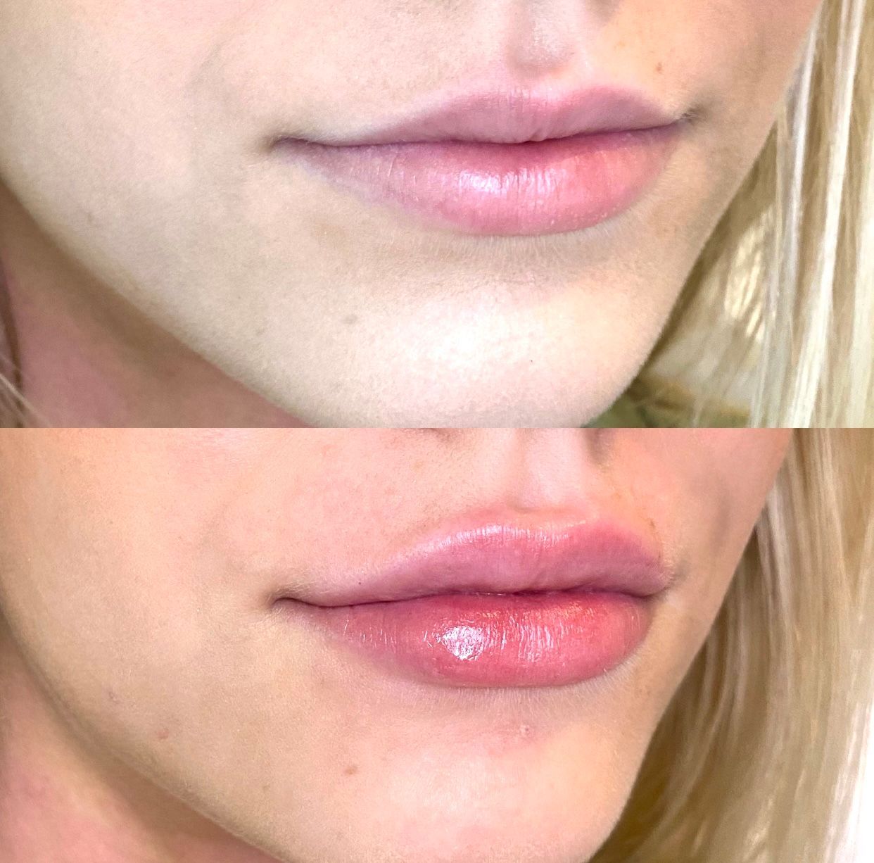 Before and after photos of lips. The bottom pair appears fuller with pink lip color.