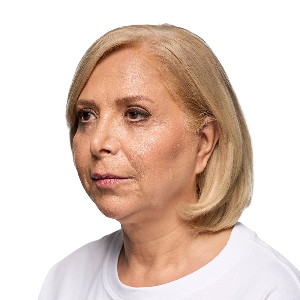 Woman with short, blonde hair and neutral expression, looking left.