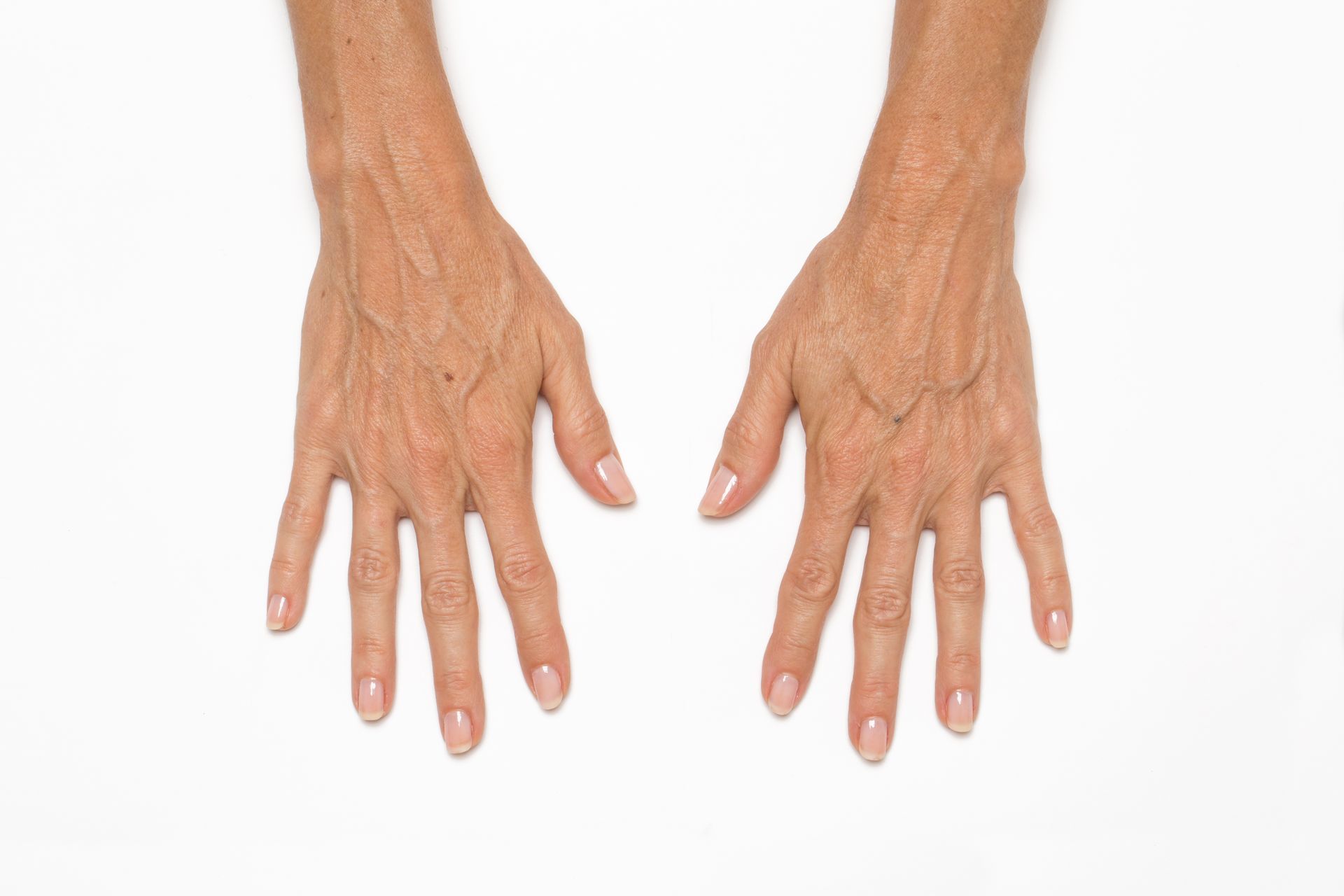 Two hands of an older person, wrinkled skin, visible veins, pale nails, palms up on white.