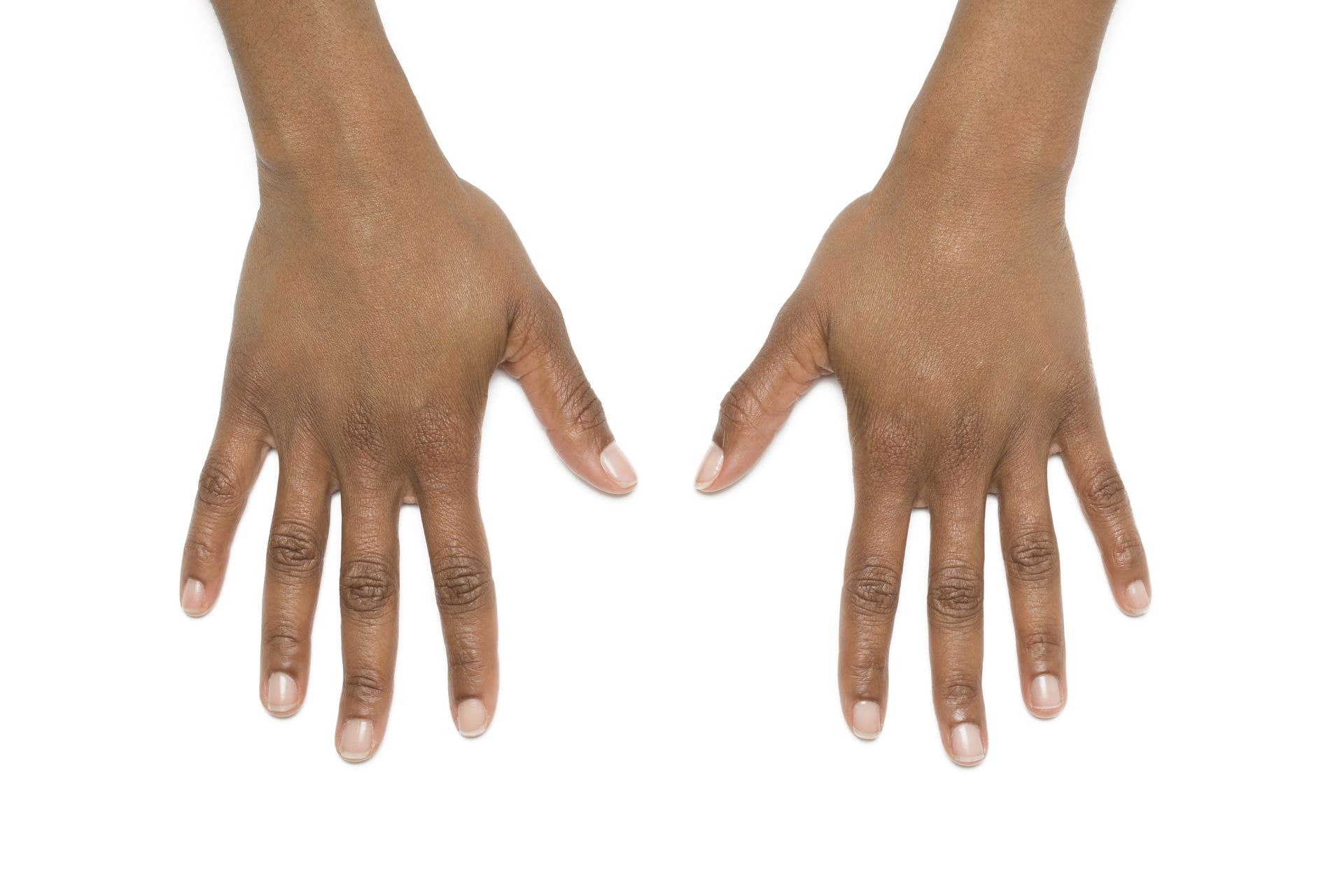 Two hands, palms up, dark skin, light-colored nails, against a white background.