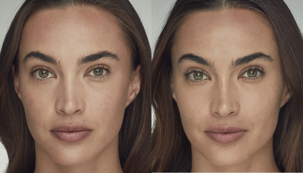 Woman's face, before and after, showing skin tone and texture changes. Right side has even skin.