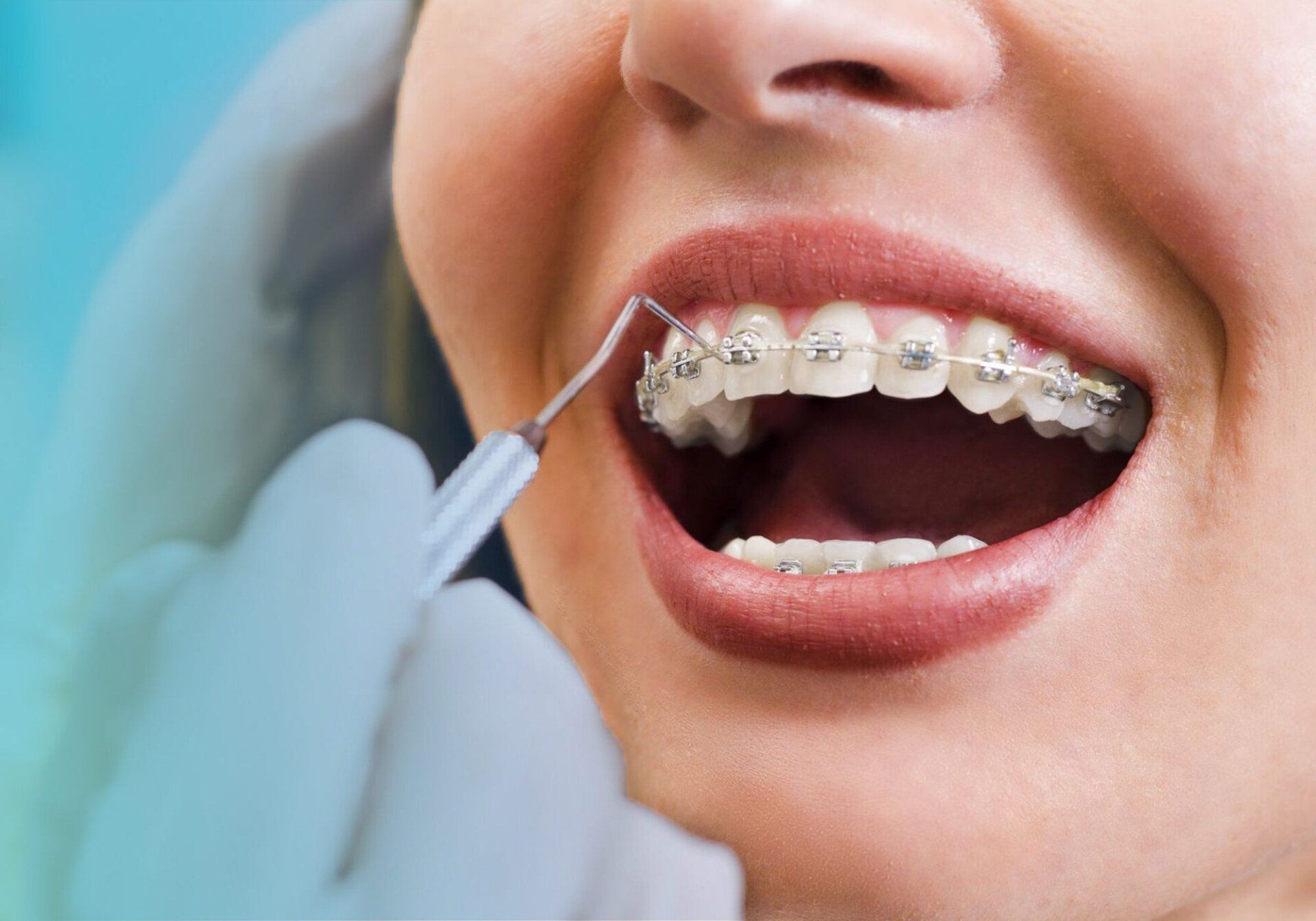Orthodontics